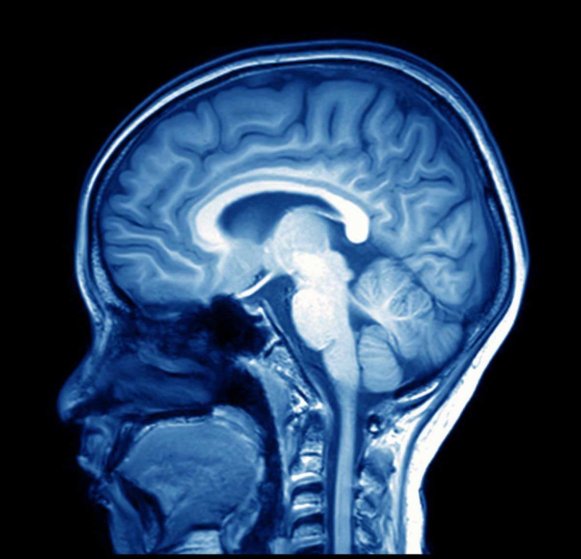 Effets de la pollution de l'air sur le cerveau : Sur les adultes et les ...